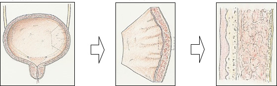 膀胱の壁